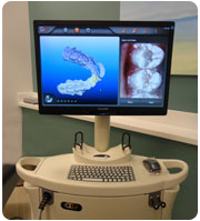 Digital Impressions For Braces