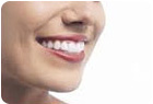 Invisalign Clear Aligners