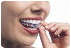 Invisalign Clear Braces