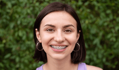 Traditional metal braces